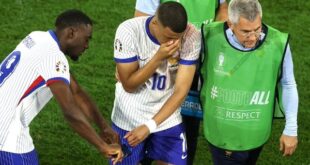 Kylian Mbappe to undergo surgery on broken nose suffered against Austria