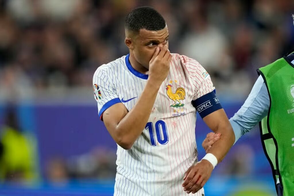 Mbappe’s Broken Nose Sours Les Bleus’ Hard-Earned Win