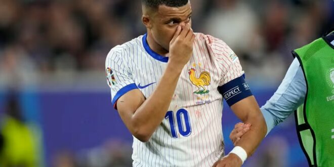 Mbappe’s Broken Nose Sours Les Bleus’ Hard-Earned Win