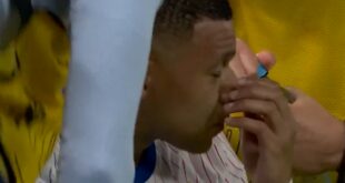 Kylian Mbappe’s nose injury gets hit again at Euro 2024