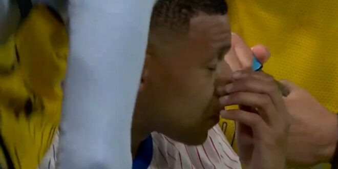 Kylian Mbappe’s nose injury gets hit again at Euro 2024